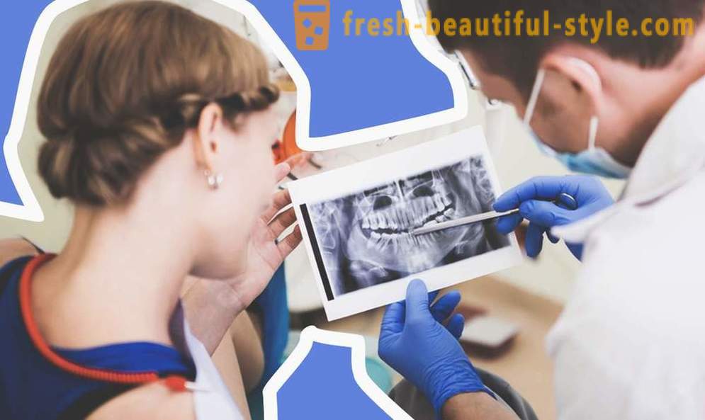 4 jautājumi par zobu implanti
