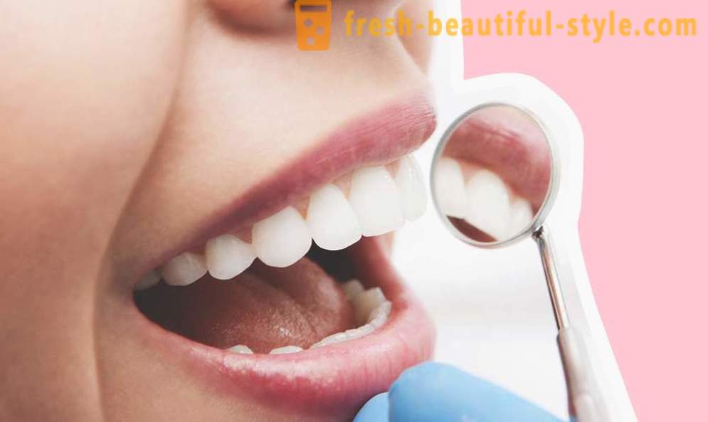 4 jautājumi par zobu implanti