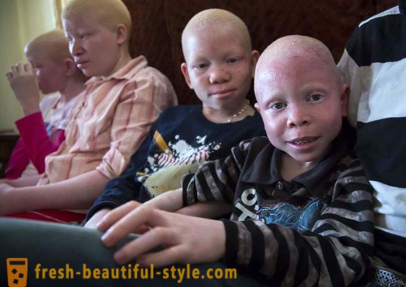 Traģiskais vēsture Tanzānijas albīnu