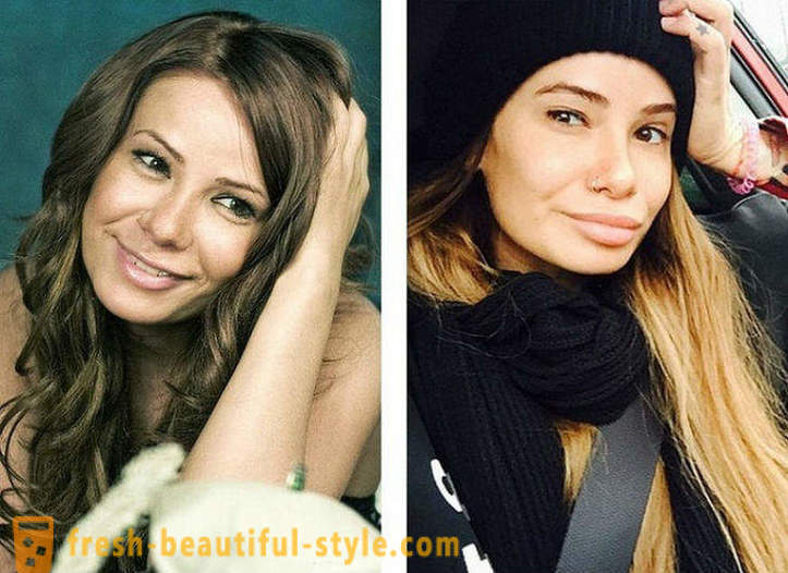 10 krievu skaistules pirms un pēc plastmasas