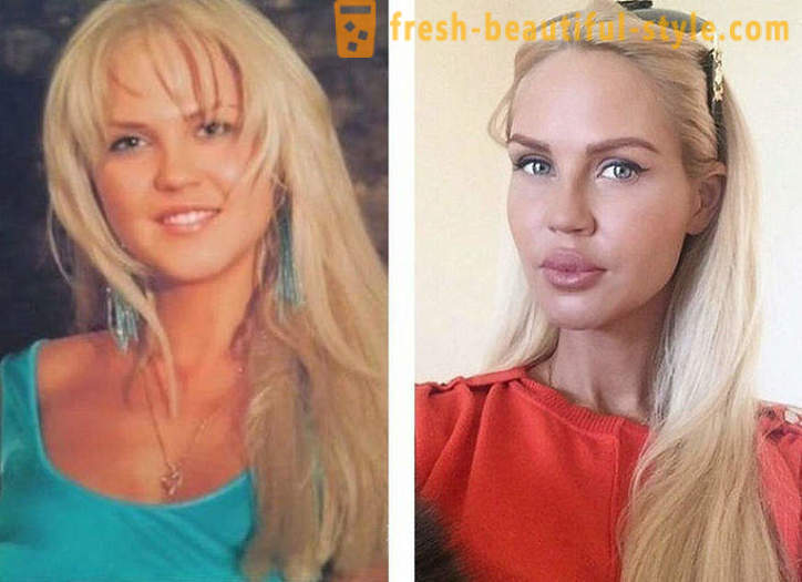 10 krievu skaistules pirms un pēc plastmasas