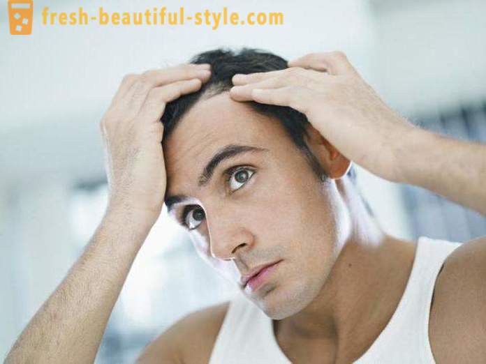 Zāles ar minoksidils matiem: atsauksmes, funkcijas un apraksts piemērojot labāko