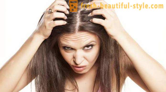 Zāles ar minoksidils matiem: atsauksmes, funkcijas un apraksts piemērojot labāko