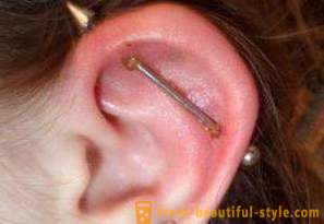 Pārdurot skrimšļa auss: ārstēšana, sekas