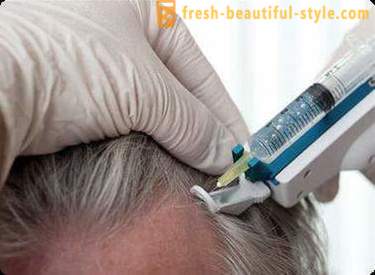 Mezoterapija matu: Aplauzums rīki un kontrindikācijām