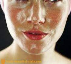 Taukainai ādai sejas: ko darīt, lai risinātu šo problēmu?